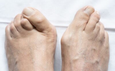 The Hidden Dangers of Wearing the Wrong Shoes: A Podiatrist’s Perspective
