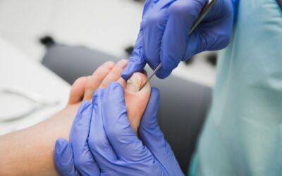 What Parents Need to Know About Ingrown Toenails in Active Teens