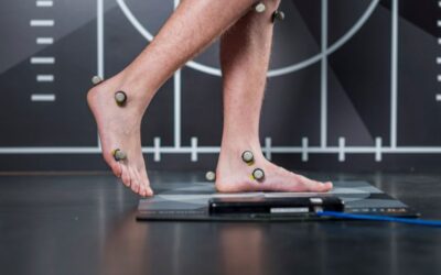 How Biomechanical Assessment Can Transform Your Running Performance